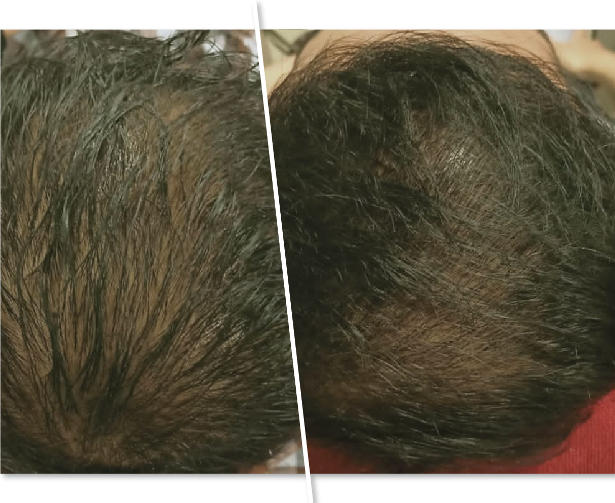 Before and After Men Hair Strengthen Treatment